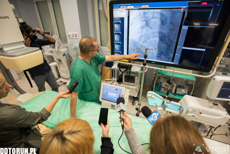 Nowy sprzęt w szpitalu na Bielanach