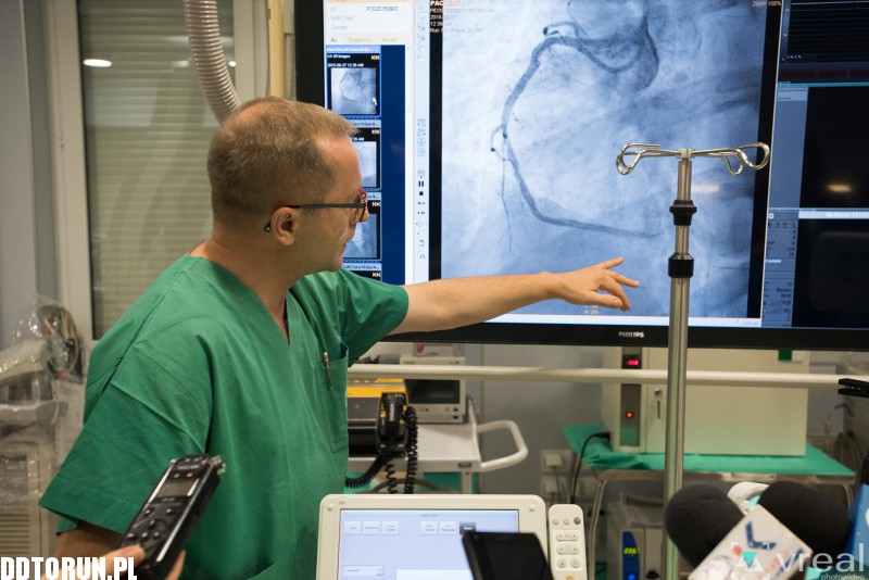 Nowy sprzęt w szpitalu na Bielanach