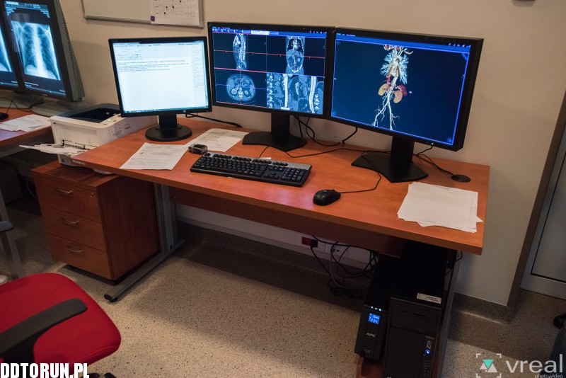 Nowy sprzęt w szpitalu na Bielanach