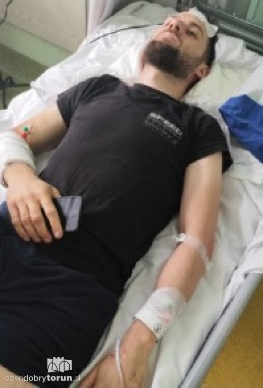 Chciał ich zabić. Tak teraz wyglądają