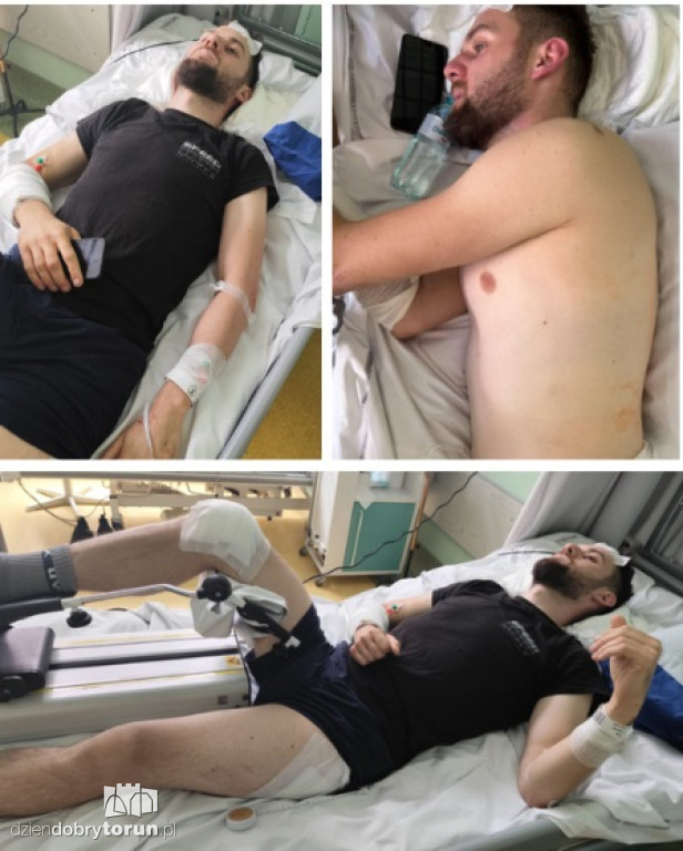 Chciał ich zabić. Tak teraz wyglądają