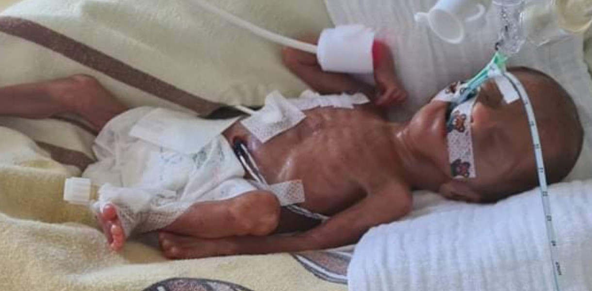 Natan ważył nieco ponad 600 GRAMÓW! Skrajny WCZEŚNIAK potrzebuje wsparcia