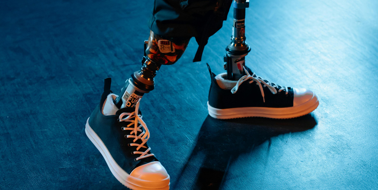 Powrót dziecka do sprawności po amputacji – jak przebiega rehabilitacja?