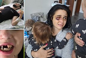 Tragedia pod klubem w Toruniu. Dwoje rodziców walczy o życie. Ruszyła zbiórka-68001