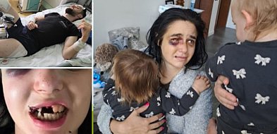 Tragedia pod klubem w Toruniu. Dwoje rodziców walczy o życie. Ruszyła zbiórka-68001