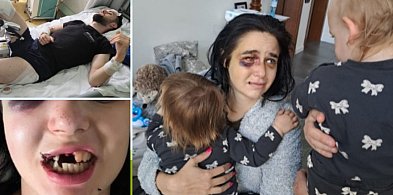 Tragedia pod klubem w Toruniu. Dwoje rodziców walczy o życie. Ruszyła zbiórka-68001